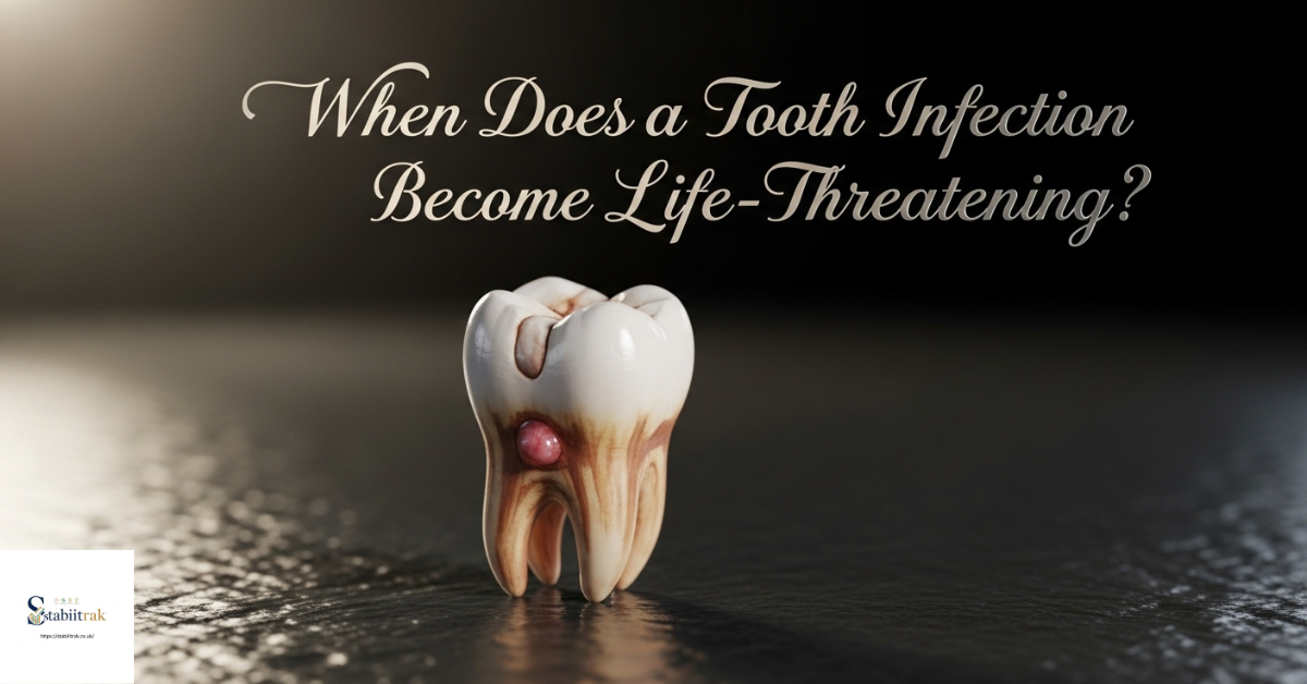 When Does a Tooth Infection Become Life-Threatening