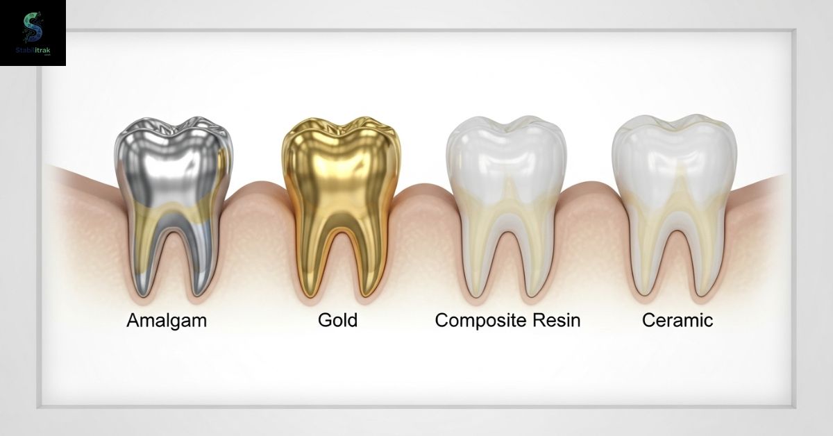 What Are the Different Types of Fillings?